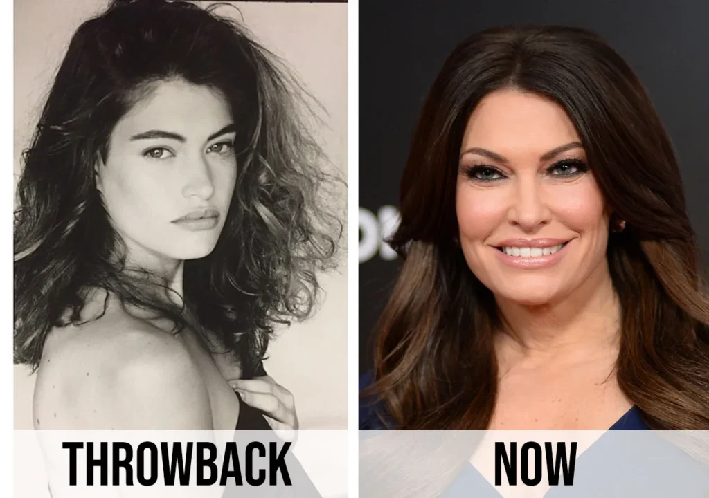 Netizens comparing Kimberly Guilfoyle’s before pictures with the current one, stating, ‘Lay off the plastic surgery; you used to be pretty